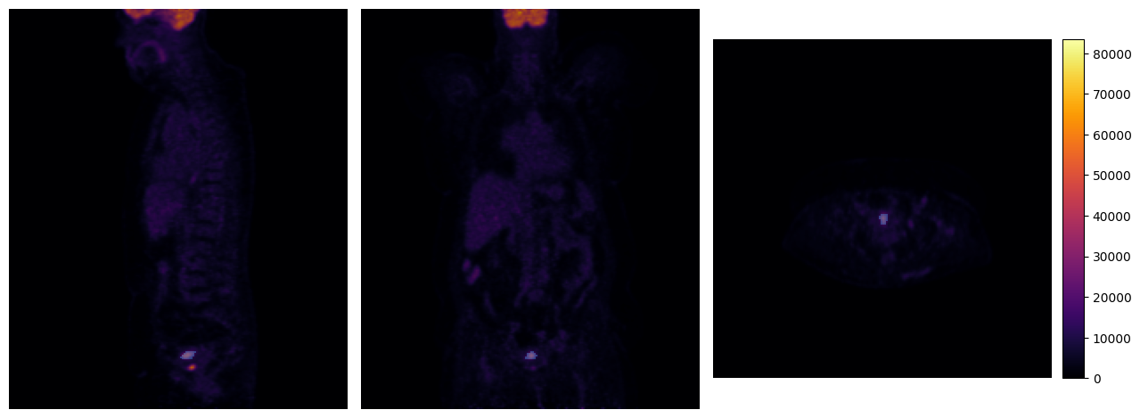 ../../_images/tutorials_imfusion-sdk_1_working_with_images_22_0.png