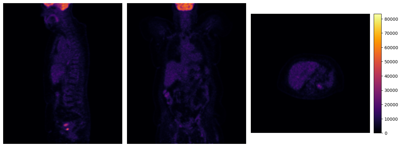 ../../_images/tutorials_imfusion-sdk_2_manipulating_images_10_1.png