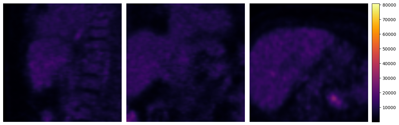 ../../_images/tutorials_imfusion-sdk_2_manipulating_images_10_3.png