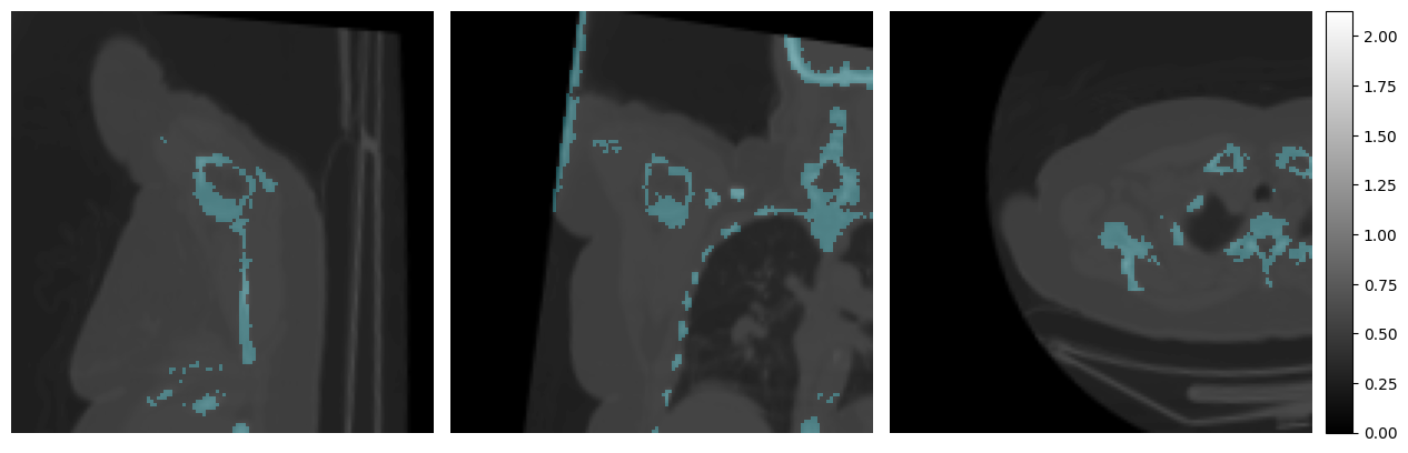 ../../_images/tutorials_imfusion-sdk_3_building_data_pipelines_9_0.png