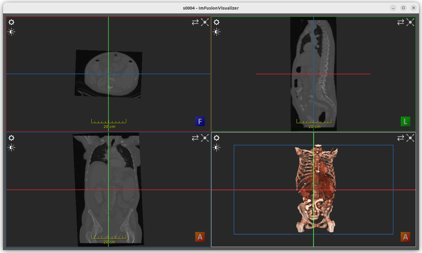 _images/visualizer_ts_ct_s0004.png