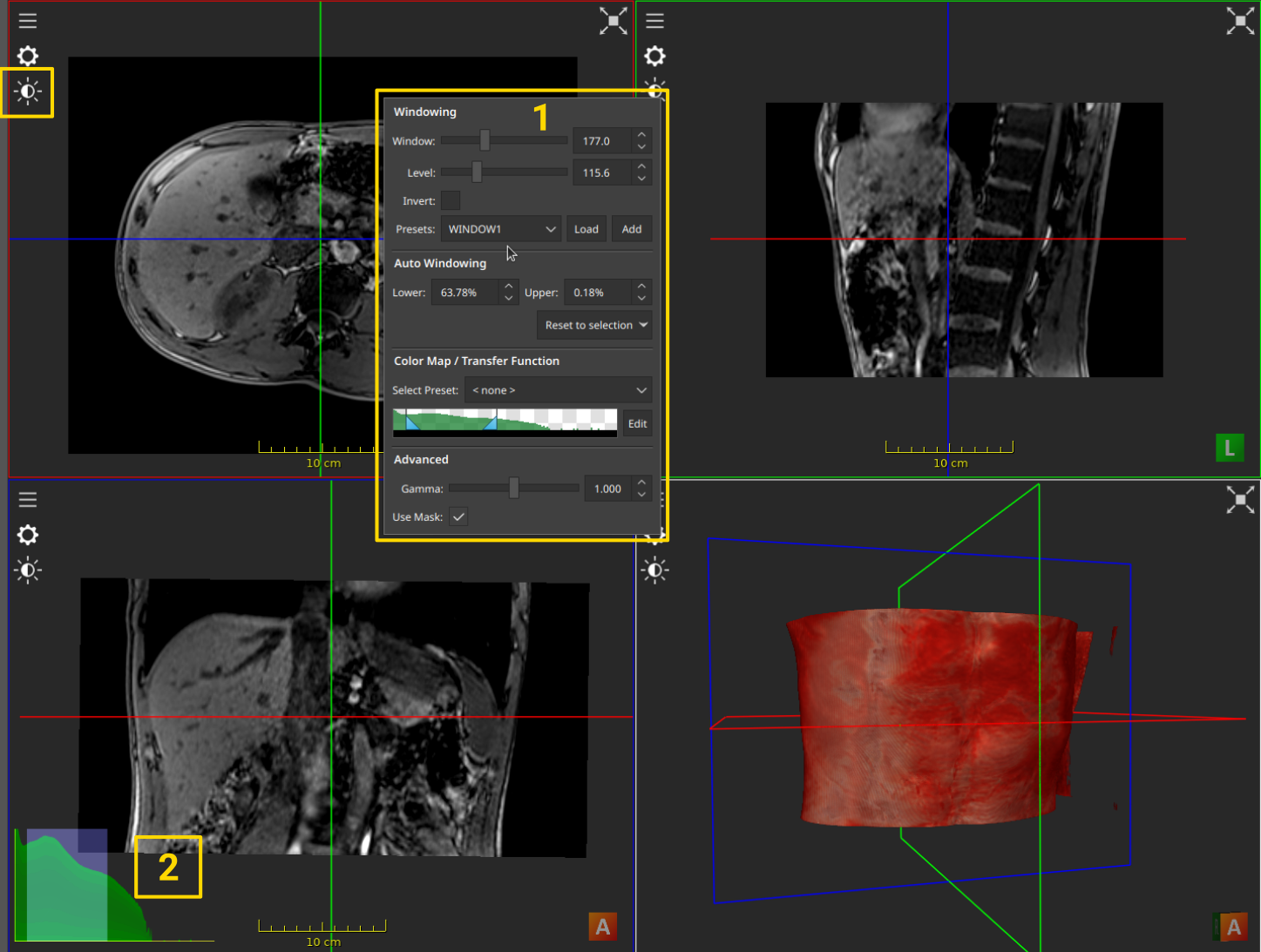 _images/visualizer_windowing_menu.png
