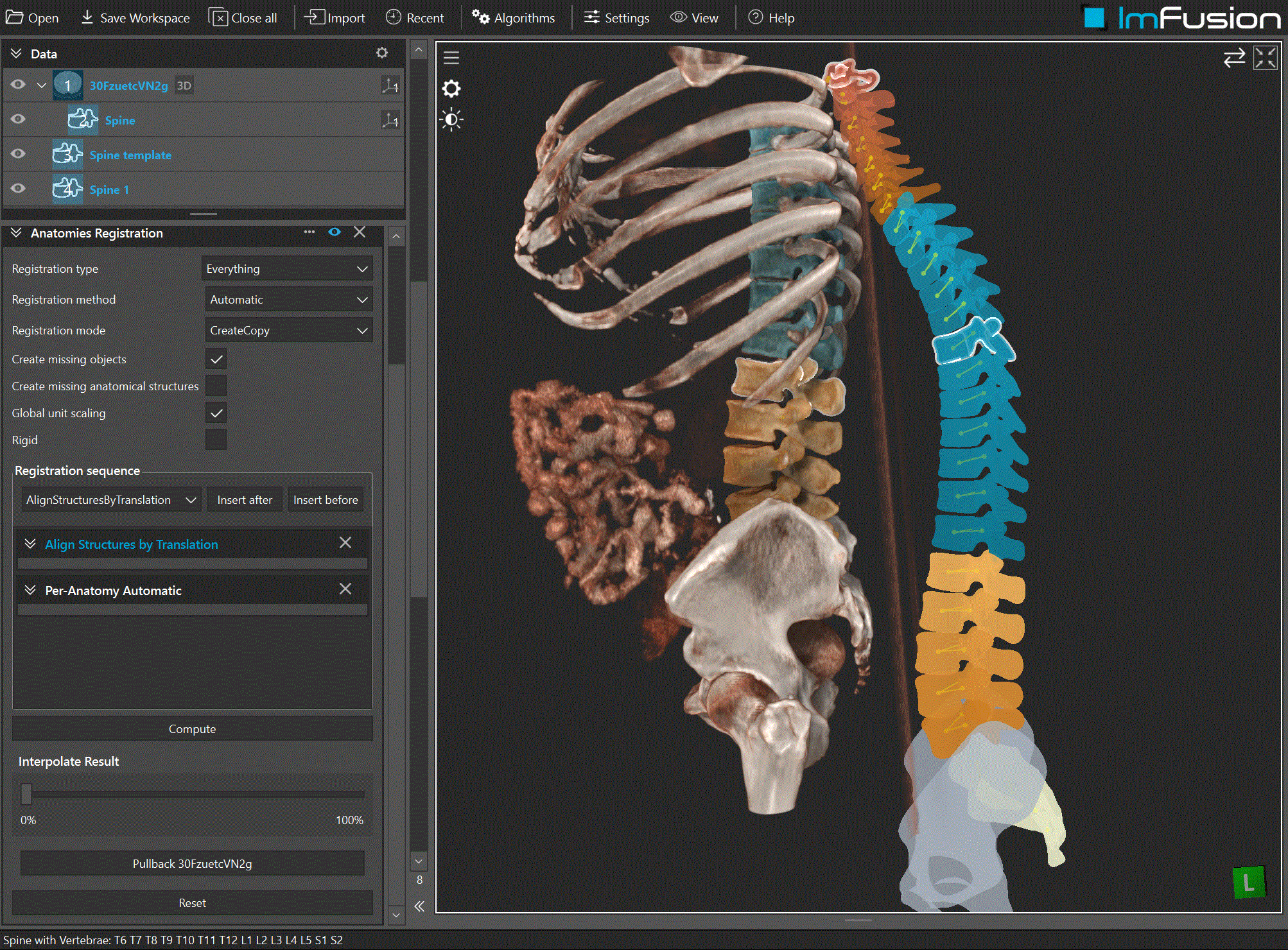 Registration interpolation