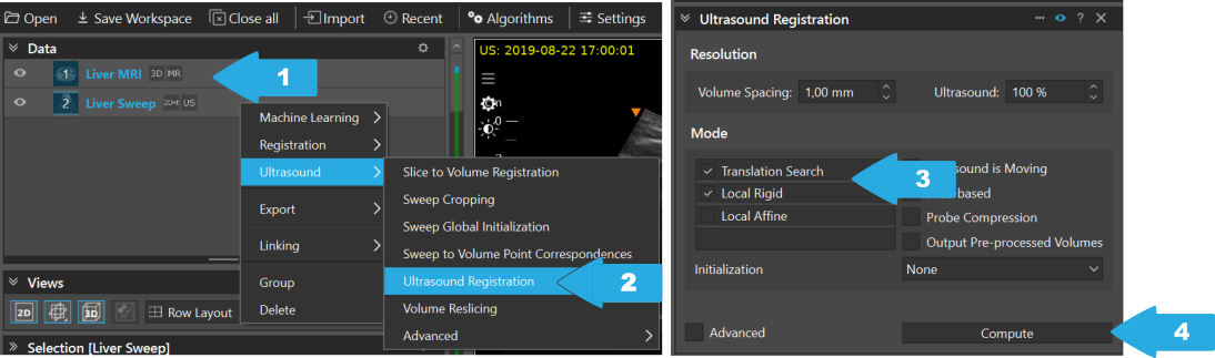 ../../_images/US.UltrasoundRegistrationTutorial.execution00.png