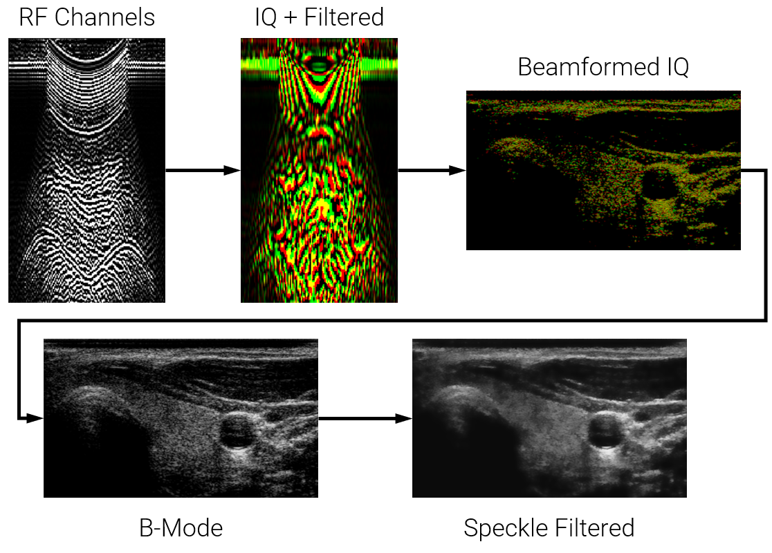 Ultrasound image formation pipeline